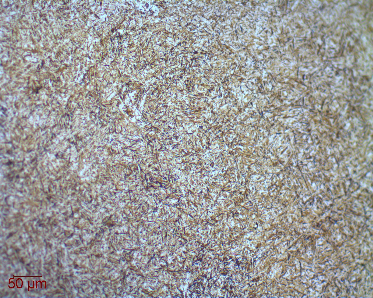A brownish microscope image densely packed with tiny dark needle-like shapes pointing in many directions.